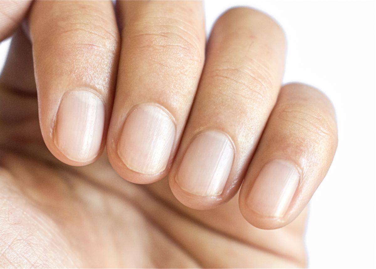 A gyenge köröm nem mindig a „korábbi szakszerűtlen műkörmöstől” van, lehet táplálkozási, hormonális vagy életmódbeli eredetű is