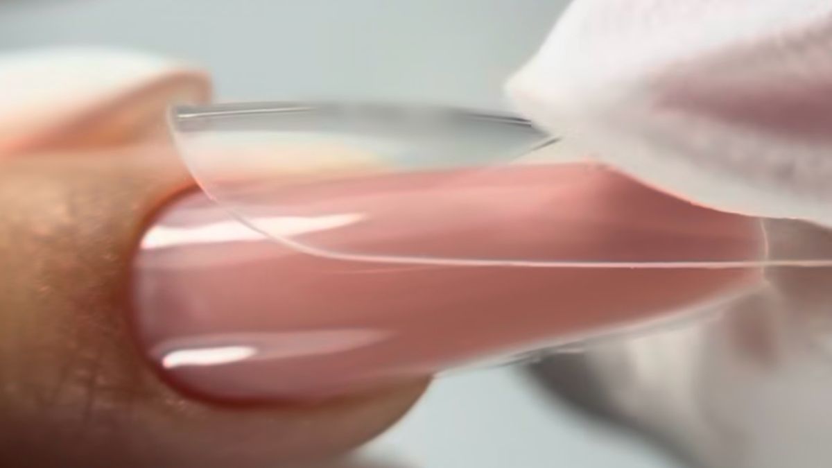 Gel tip technika