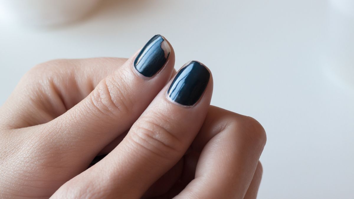 felvált, lepattogott géllakk